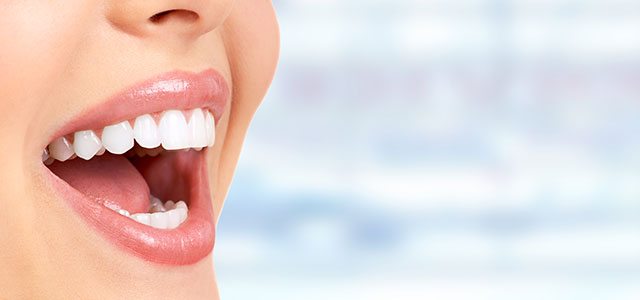 teeth whitening