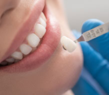 dental crowns treatment