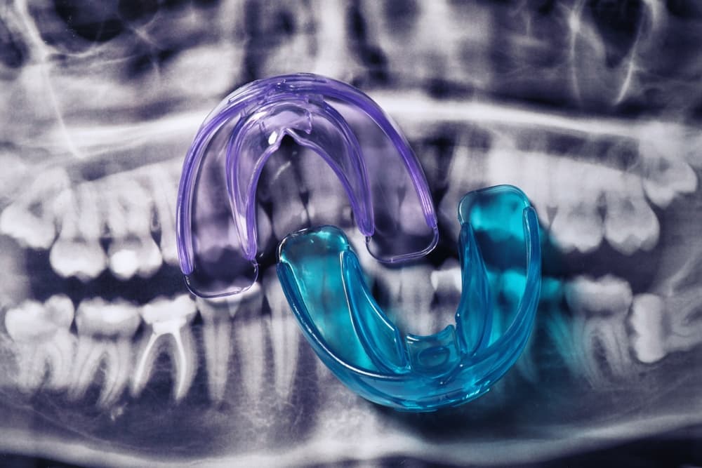 Mouthguards