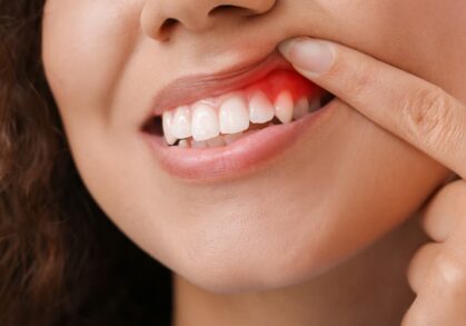 The Importance of Periodontal Treatment for Overall Health
